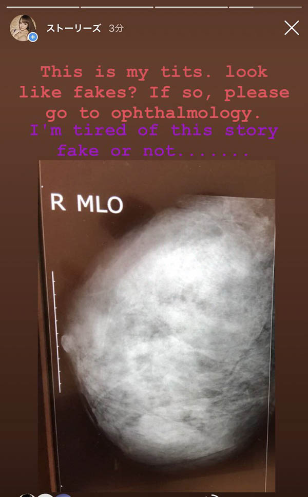 图片[4]-暗黑第一球霸《Hitomi》精选作品推荐介绍及封面预览-吾尤客